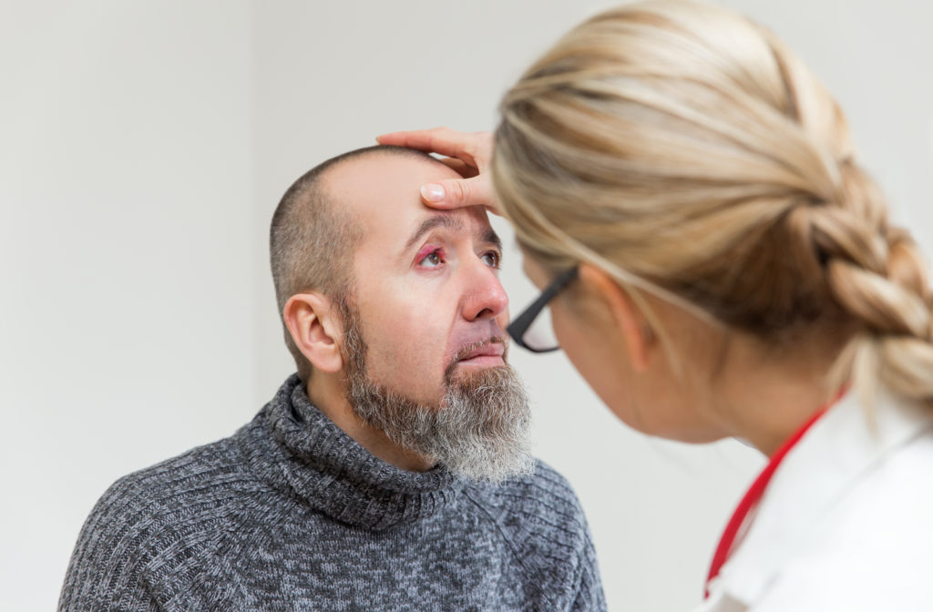 Optometrist doing eye exam on man with stye on his eye
